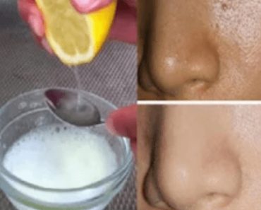 Just By Using 2 Ingredients Your Pores Will Disappear Forever And Your Face Will Be Cleaner Than Ever!
